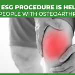 How ESG procedure is helpful for people with osteoarthritis